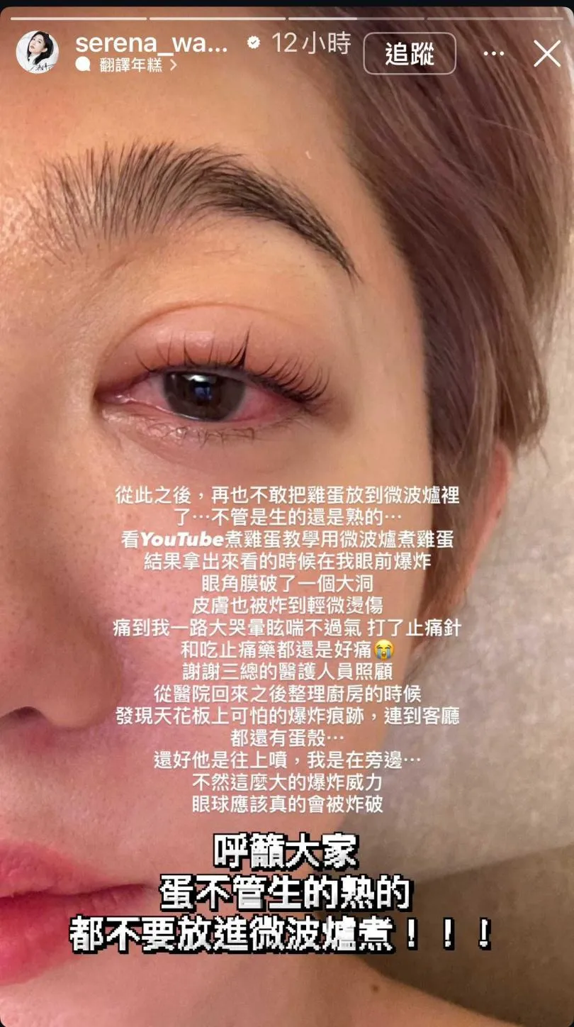 王晴微波雞蛋,取出當下蛋在她眼前爆炸,導致她眼角膜破洞。(圖/翻攝自王晴IG)