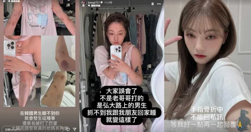劉力穎曝光傷照。（圖／翻攝自劉力穎IG）