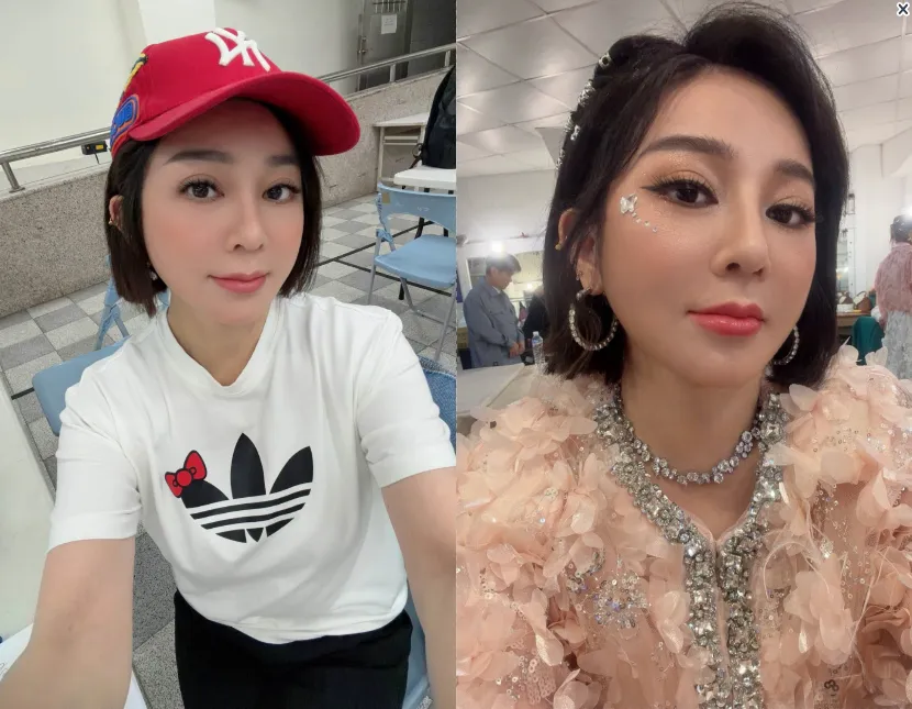 王彩樺的鼻子目前已消腫許多。（圖／翻攝自王彩樺臉書）