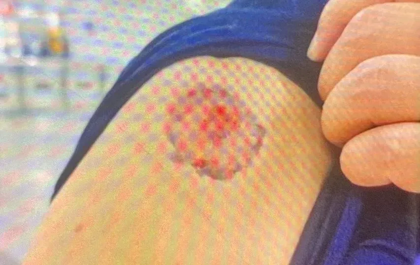 男子手臂遭咬傷留下大片血痕。（圖／翻攝畫面）