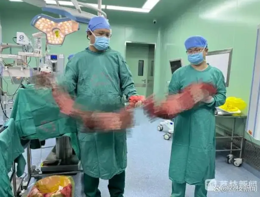 醫師動手術從柏男腹中掏出2米「巨蟒」壞死結腸。(圖/翻攝荔枝新聞)