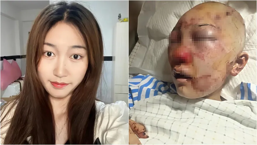 磚頭暴打、摳眼拔舌…20歲正妹遭變態尾隨　滿頭血癱倒公廁恐毀容