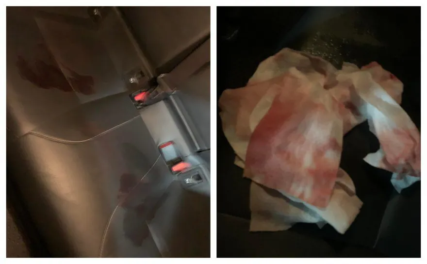 情侶搭小黃…後座神秘液體亂流！司機手抹「一片腥」曝真相　網嗆：胎戈渣某