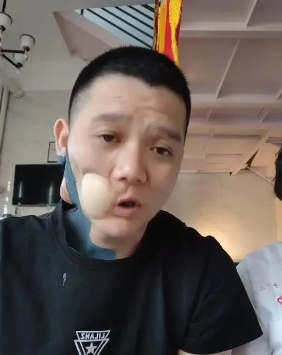 男子白點潰瘍疼痛、不癒合竟是口腔癌2期　術後戒檳榔、菸酒終於能吃滷肉飯