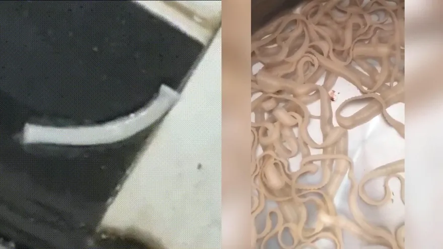 還在動！女子體內排出近5公尺寄生蟲 竟是因為吃了這東西…