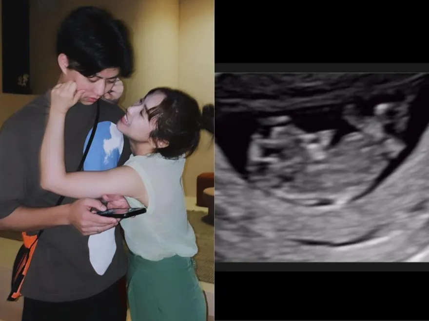 快訊／ 吳姍儒懷孕了！和老公放閃甜曬「超音波照」