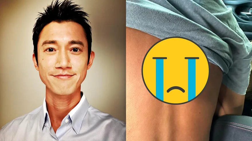 吳慷仁慘遭「虎頭蜂叮一大包」！拍戲出意外急送醫　痛喊：像被踹再用220V電擊