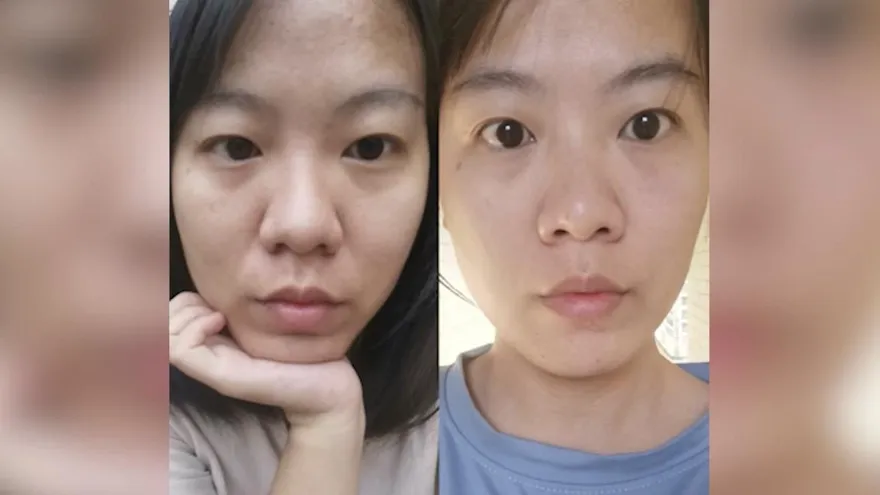 懶人保養大法！研究生堅持10點睡　亮顏淡紋宛若回春