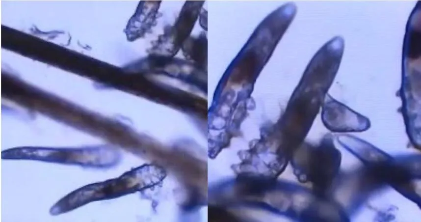 驚！蟎蟲入侵母女眼　竟是寵物惹的禍