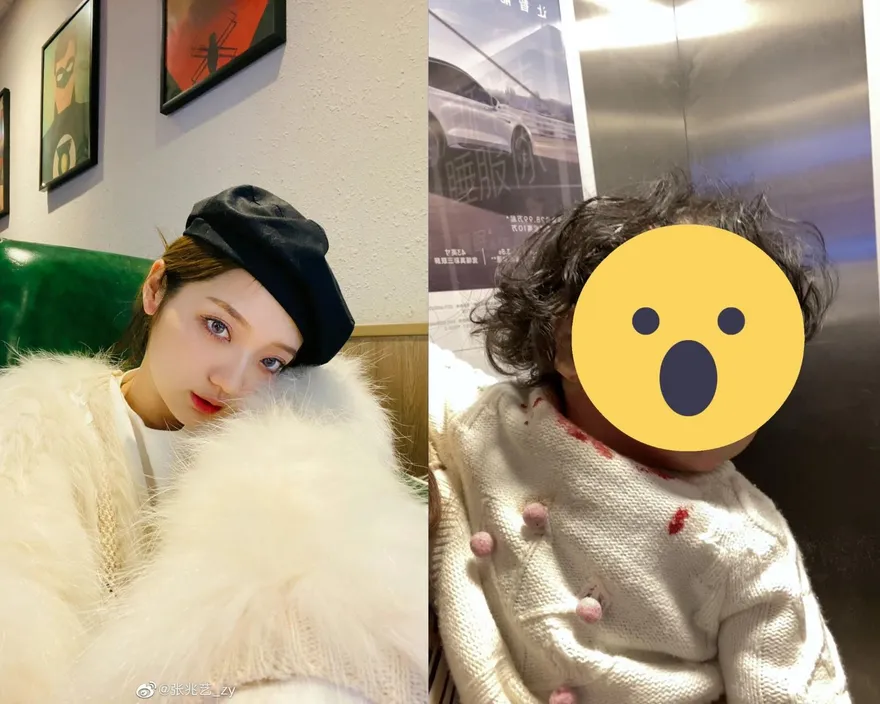 28歲女星家中慘遇爆破意外！1歲女頭部受創「血流滿臉」驚悚畫面曝　剛解封就奔醫院