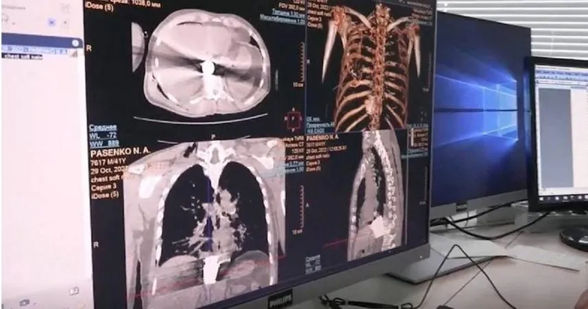 俄兵炸彈襲胸！「穿肋刺肺」卡心臟、主動脈中間　他竟奇蹟般存活