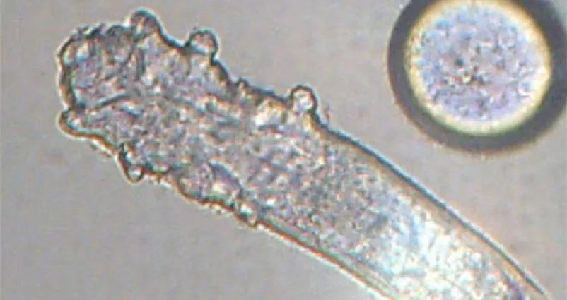 視力模糊又腫癢！她就醫驚見眼瞼「上百隻蟎蟲」亂爬　每根睫毛藏9隻