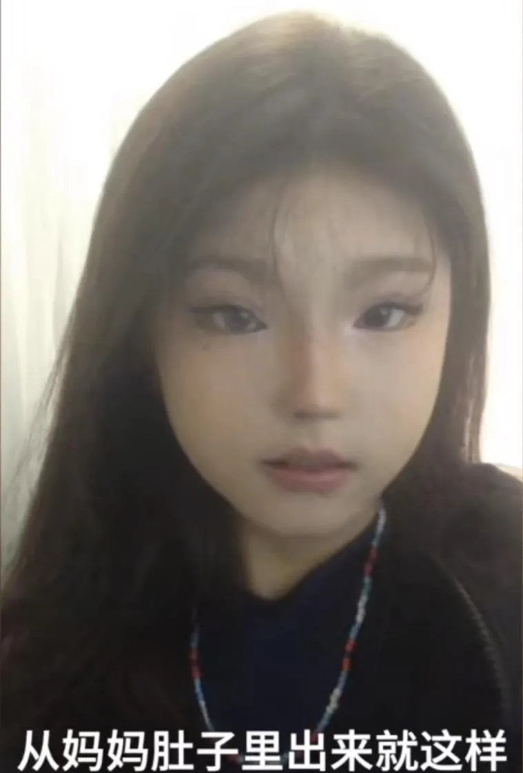 天生異瞳！18歲少女「右眼藍色」一度自卑　靠友轉變心境蛻變自信少女