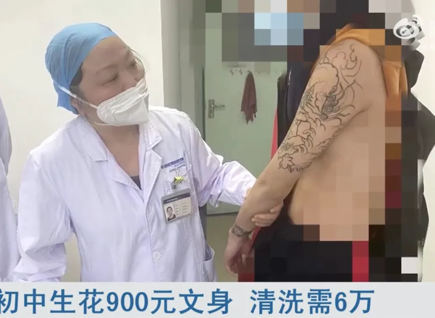 15歲兒4000元刺青「清除需花26萬」母崩潰　網轟：耍酷也要有分寸！