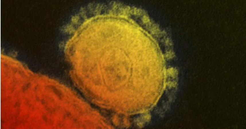 看球賽恐被「8種」病毒傳染病風險「包括MERS」　專家示警：避免接觸駱駝