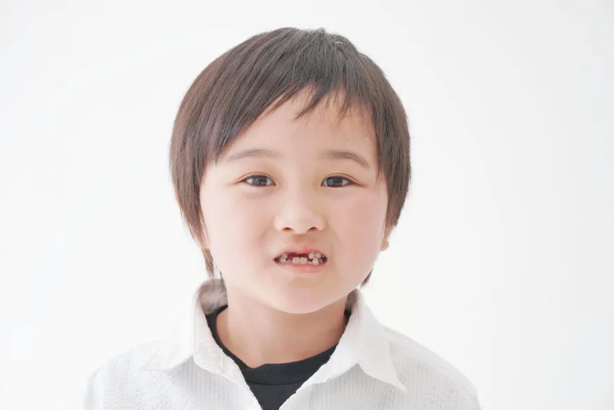 門牙縫「漏風」又漏財！ 牙醫師3招修補牙縫成功搶救門面