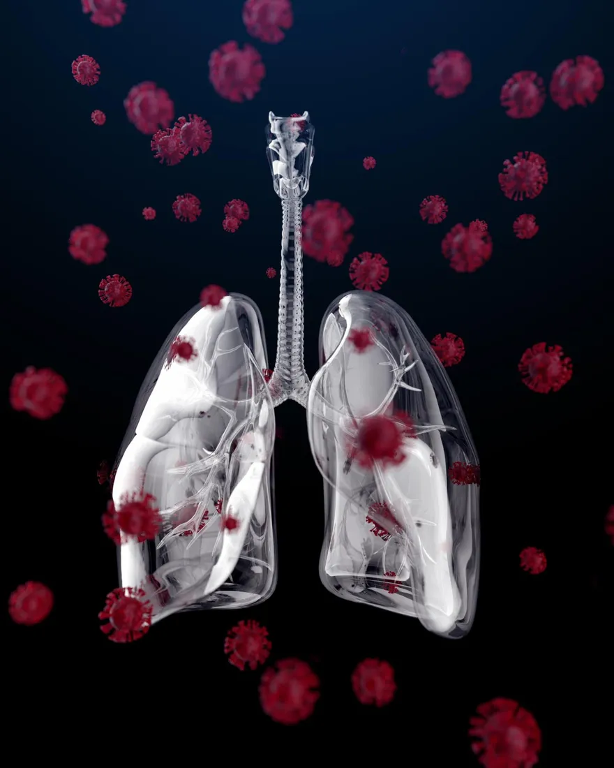 對症下藥！6旬癌婦肺感染　北榮創新方式「精準診治」找出病因