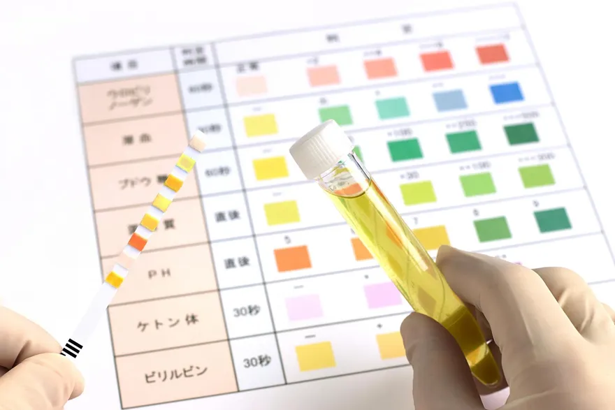 尿液1色才正常！「烏龍茶色」身體出狀況了　透明無色恐腎病前兆