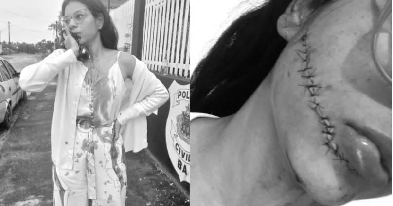 女網紅搭公車遭襲擊！睡醒見「嘴到耳朵被割開」　血染上衣畫面曝