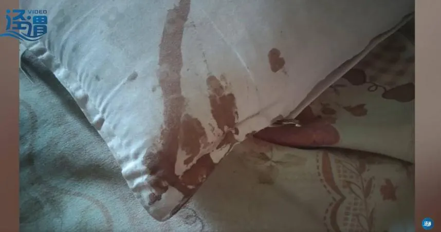 伸手一摸後腦勺「濕濕的」…睡覺疑遭「老鼠咬破頭」枕頭一片血　男嚇傻：馬上領養一隻貓