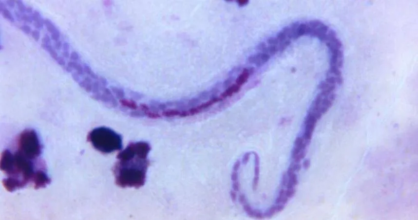 噁！男子下體疼痛1個月　醫生檢查驚見「寄生蟲在蛋蛋內開轟趴」！