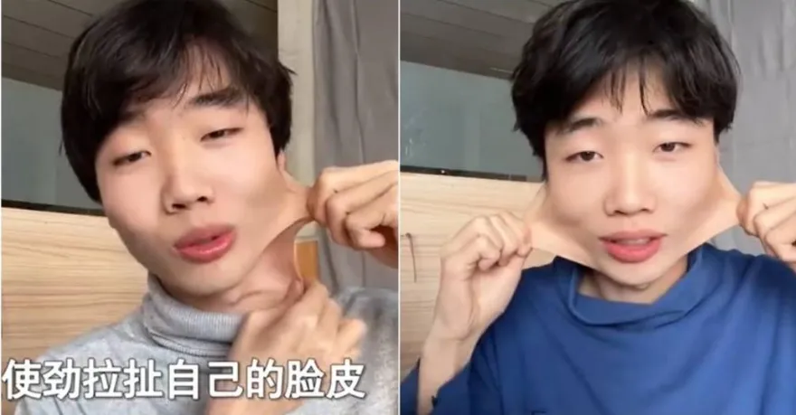 少年臉皮「能拉長10公分」喊不痛！　網嚇：皮肉分離？