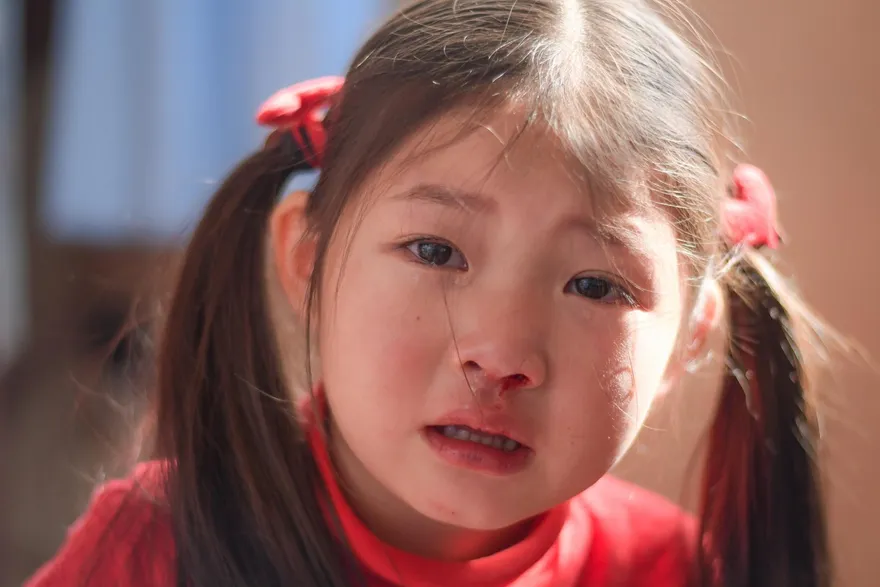 天冷鼻血狂流！醫：保護鼻黏膜「這個」超有用！