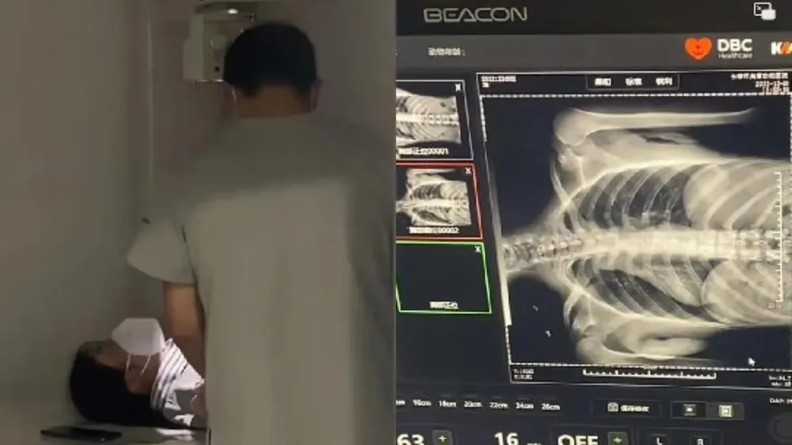 憂感染！陸民排隊照肺暴增6倍　員工狂咳不止…寵物醫院「跨界」拍CT