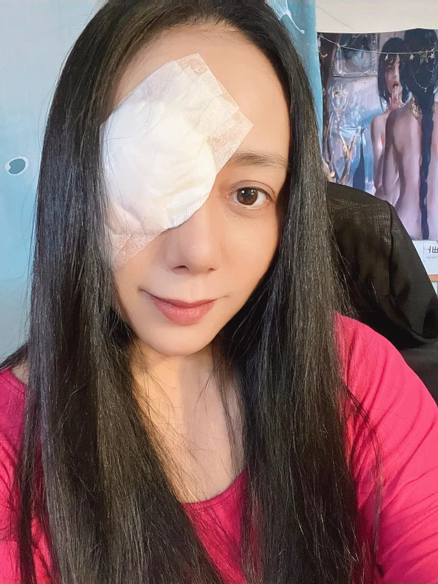 高慧君「甲狀腺功能低下」引發眼疾！醫曝視力出現「3情況」快驗抗體