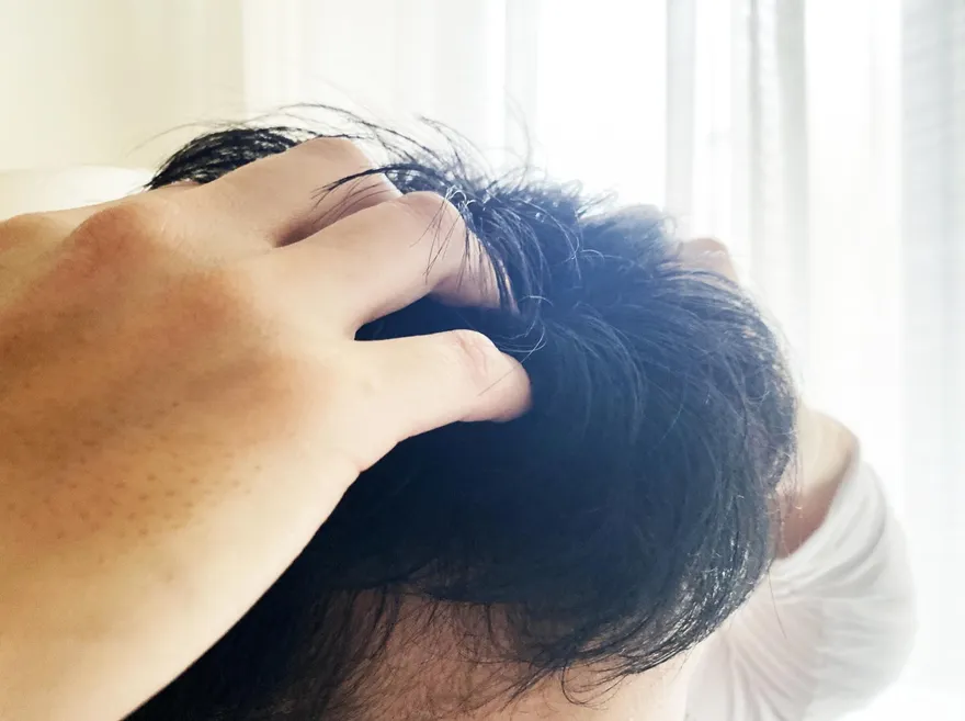 頭皮癢一搔就「飄雪」！醫授5招改善頭皮屑「洗頭水溫要適中」