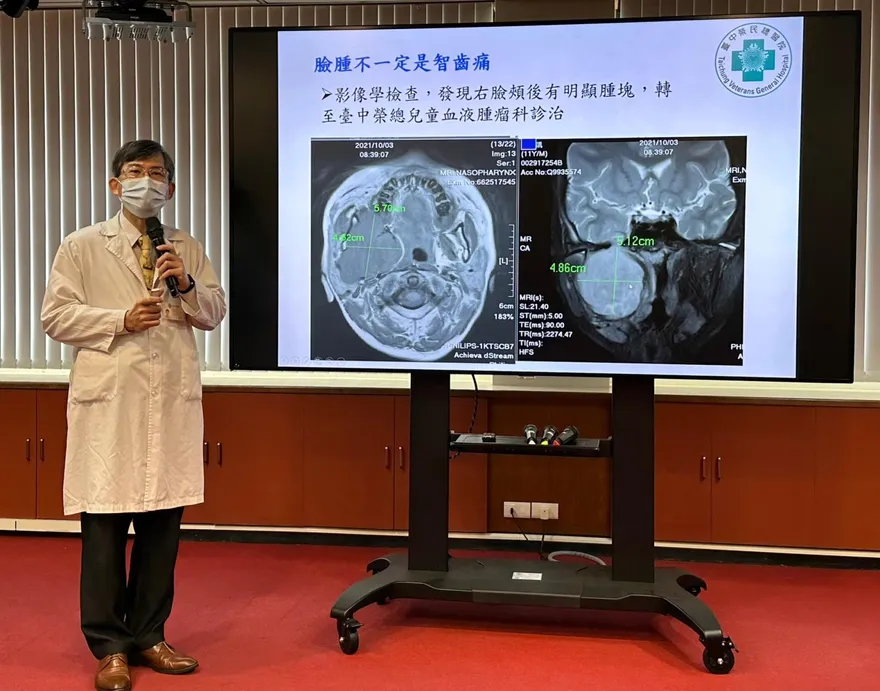 臉腫不一定是智齒作祟！12歲男童臉腫竟長「橫紋肌肉瘤」