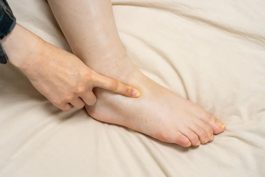 每天起床腫兩倍？網友推4大「消水腫 」方法　喝水也有效！