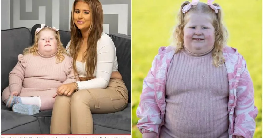 5歲就44公斤！英國女童罹罕病瘋狂爆吃　媽心累嘆：想把廚房上鎖