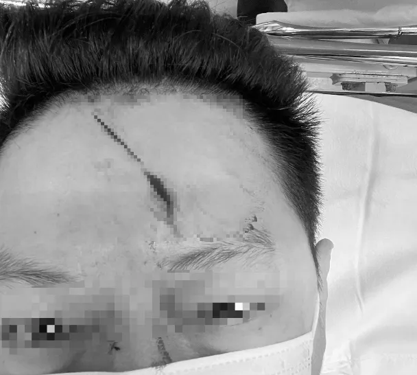 影/超慘！男逛新竹年貨大街遭電線絆倒撞頭縫10針　幼子也受傷市府急處理