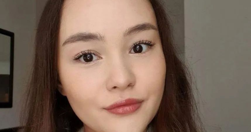 25歲正妹患嚴重濕疹「被誤會自殘」　淚嘆：同學嚇到不敢靠近我