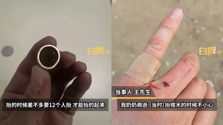 阿嬤保佑！千斤棺蓋突滑脫重壓...靠戴10年戒指保住手指