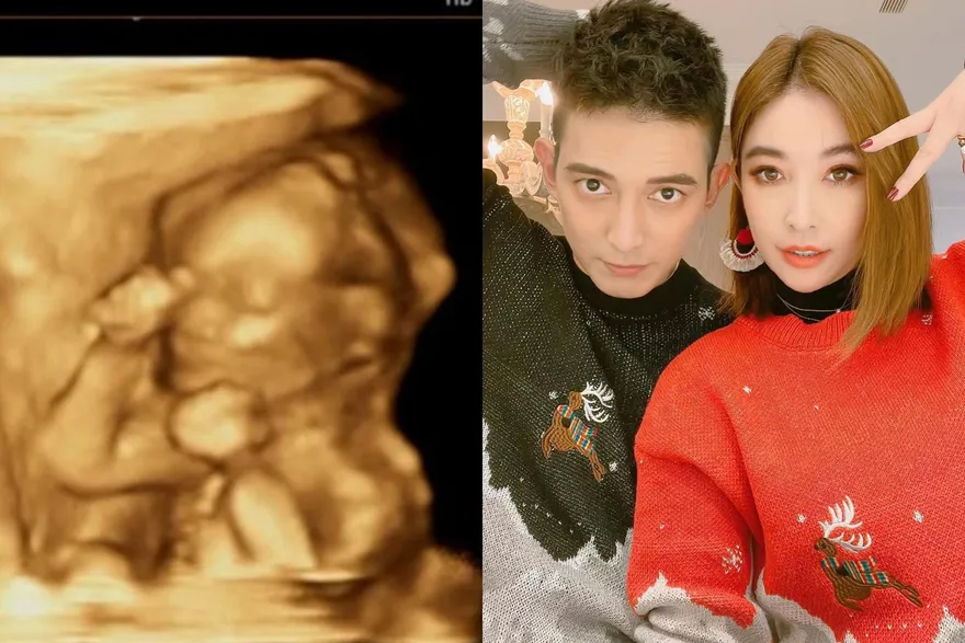 王家梁曬忒忒超音波照！超萌「微笑比讚」神複製父母高顏值