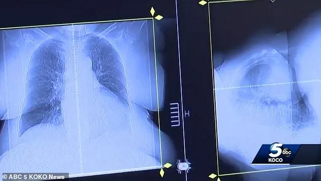 癌末男新偏方吃「狗驅蟲藥」！三個月後奇蹟癌細胞全消失
