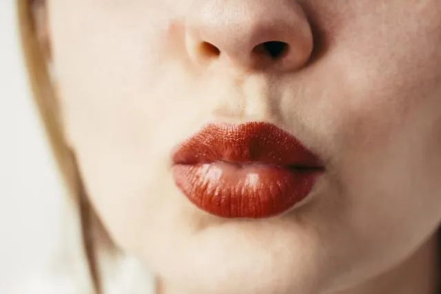 做完豐唇手術竟「腫脹到快爆炸」！18歲正妹腫成豬頭　網嚇歪：你哪位？