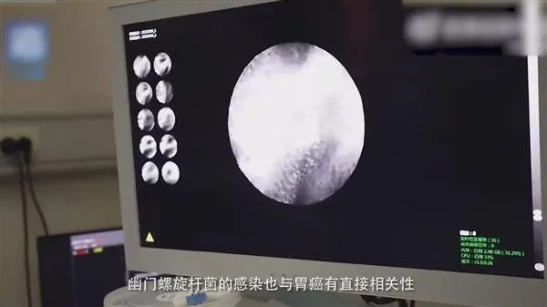 一胃痛就喝熱水...女半年後得「胃癌」　醫點出「這些因素」導致