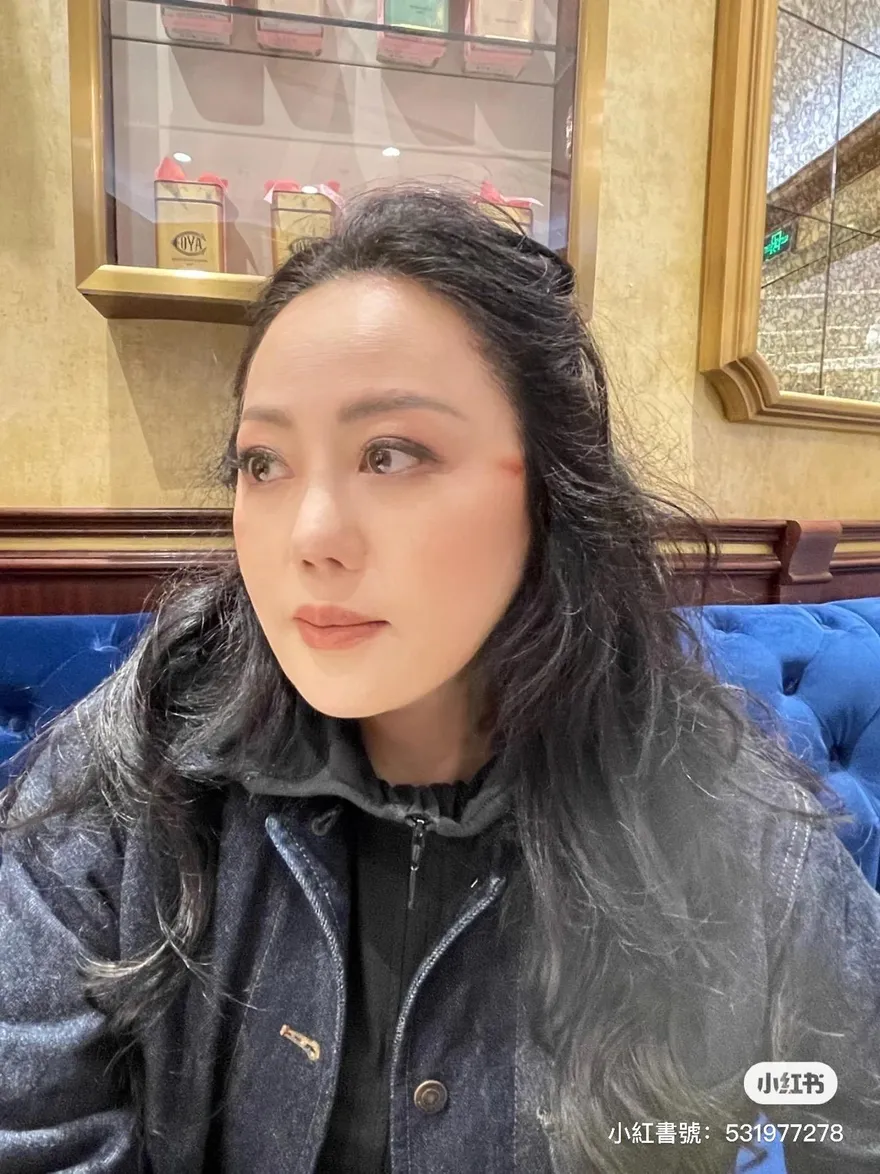 《黑暗榮耀》同款疤！章小蕙慘遭「電髮棒燙傷」險破相 臉上驚現紅色疤痕急向網民求救!