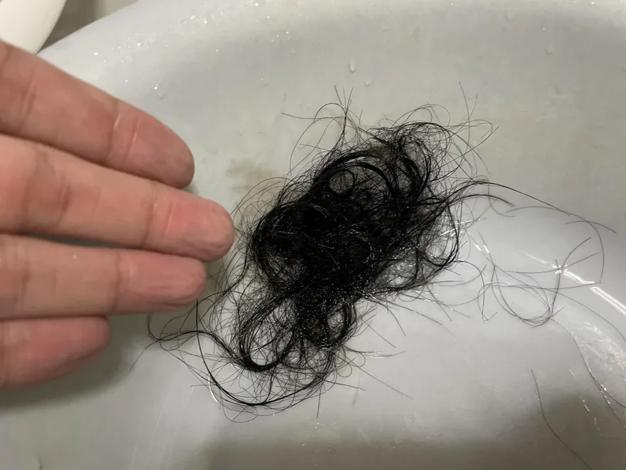 養髮液能改善落髮？頭皮與掉髮問題 醫師教你5招克服