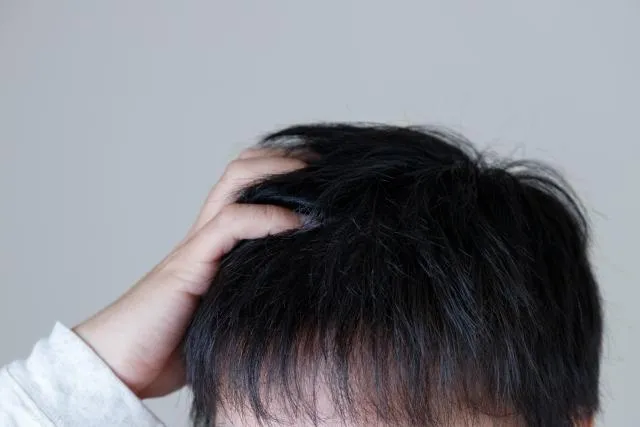 阿伯頭皮痘痘擦藥沒好竟是「胃癌末期」　醫曝「5警訊」！