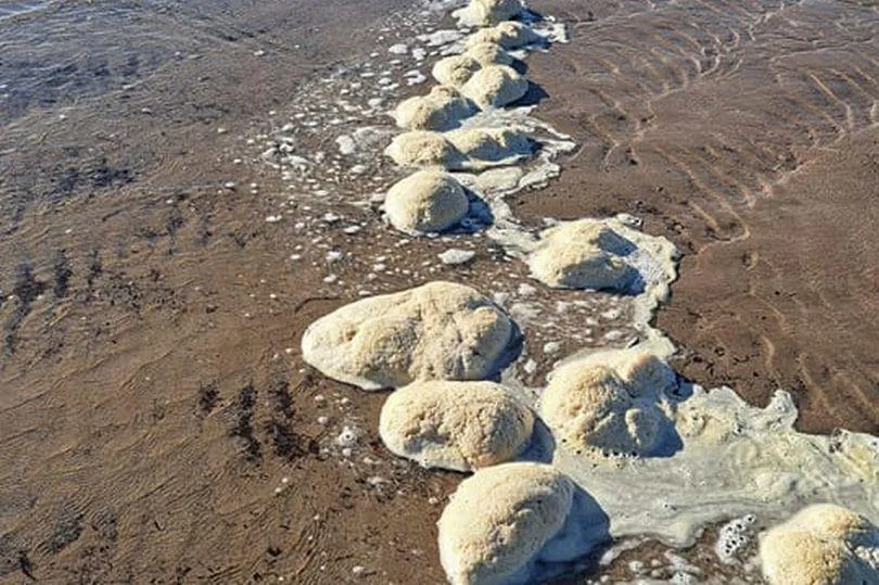 詭爆！英國海灘突現「整排白色大腦」　路人嚇：像外星人