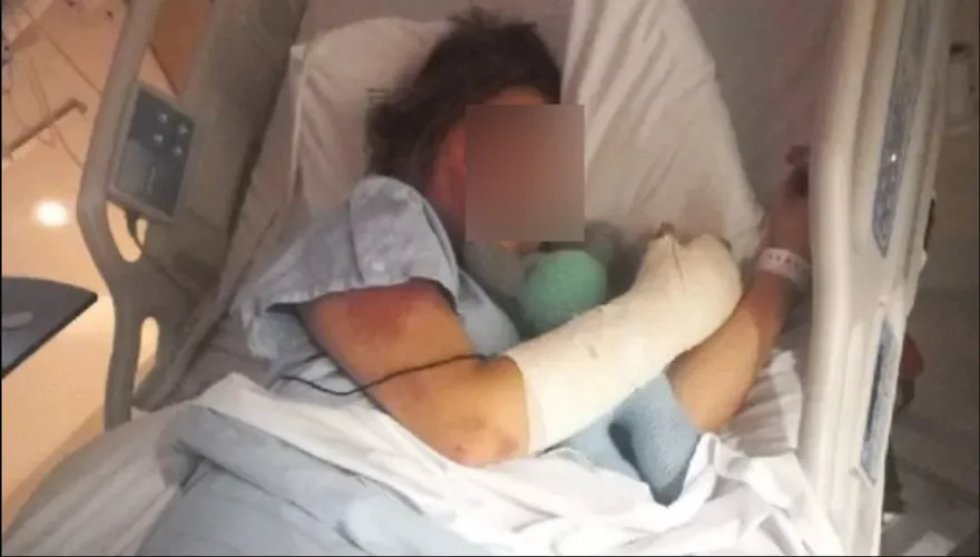 現實版黑暗榮耀！13歲女孩參加閨密派對中伏　她被脫半裸遭火燒刀割4小時
