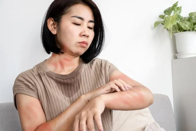 夏季防1蟲！一碰這蟲恐害皮膚潰爛、起水泡
