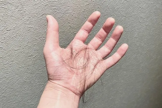 別擔心！一天掉髮100根很正常　吃素、少肉食、吃藥都會影響落髮狀況