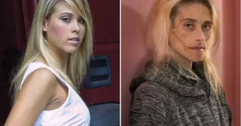 以色列35歲名模離世　被厭食症折磨13年牙掉光　病逝時僅23公斤