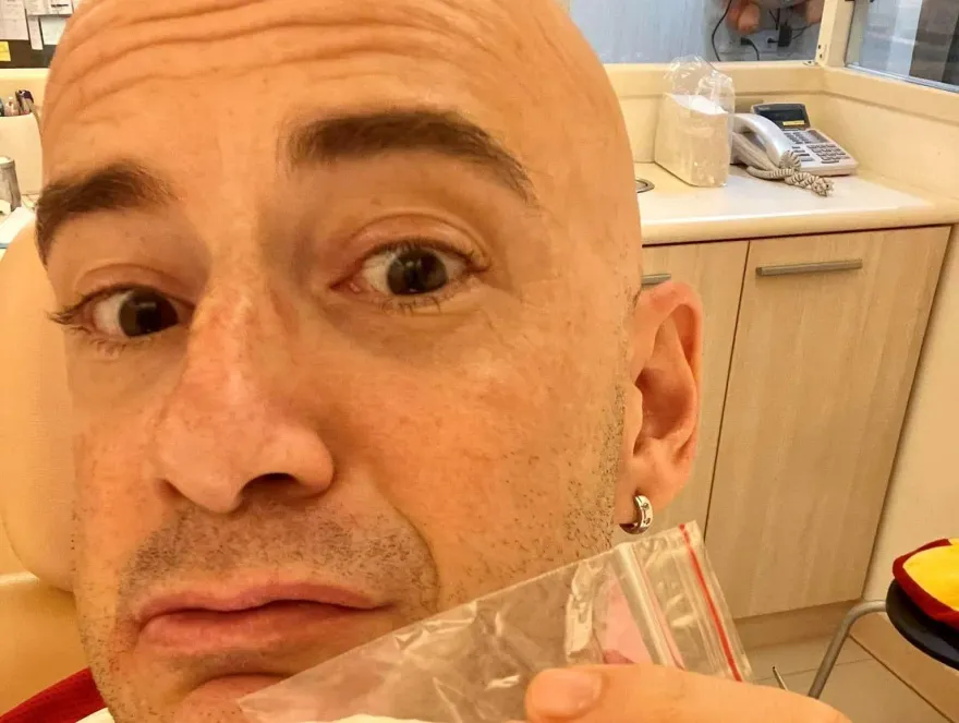 首度在台拔牙！吳鳳「秀齒」大讚：台灣健保真好、國外至少好幾千