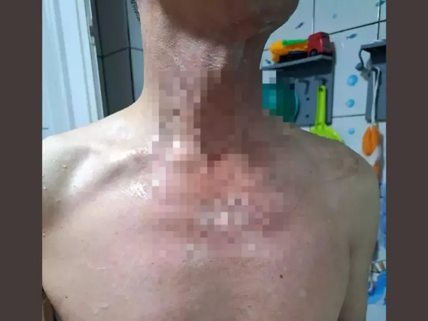 竹北氣爆案/瓦斯管砸下來…廚房瞬間爆炸！他內褲被炸破裸逃傷勢曝